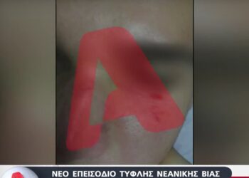 Ντροπή και αίσχος: Ξυλοκόπησαν άγρια ανήλικο στον Ηλεκτρικό επειδή είχε τσαντάκι με την ελληνική σημαία!