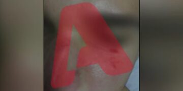 Ντροπή και αίσχος: Ξυλοκόπησαν άγρια ανήλικο στον Ηλεκτρικό επειδή είχε τσαντάκι με την ελληνική σημαία!