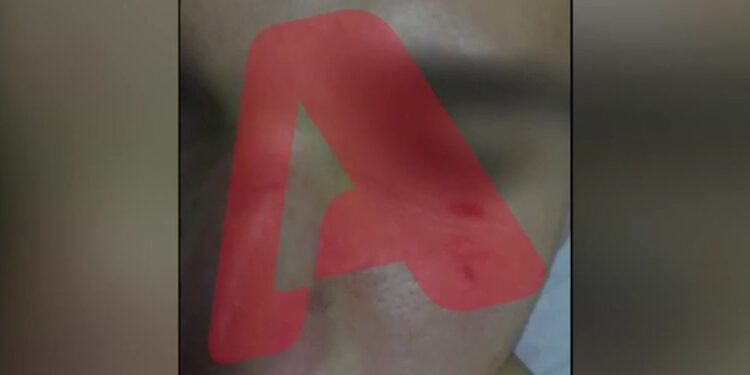 Ντροπή και αίσχος: Ξυλοκόπησαν άγρια ανήλικο στον Ηλεκτρικό επειδή είχε τσαντάκι με την ελληνική σημαία!