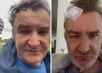 Σε κλινική του Ανόβερου ο Νίκος Ορφανός – «Είχα όγκο στο κεφάλι»