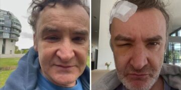 Alldaynews.gr Σε κλινική του Ανόβερου ο Νίκος Ορφανός – «Είχα όγκο στο κεφάλι»