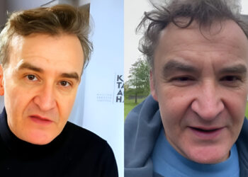 Νίκος Ορφανός: Χειρουργείο για όγκο στον εγκέφαλο για τον γνωστό ηθοποιό – «Δεν ήξεραν τίποτα για αυτό που αντιμετώπιζα, το έμαθαν την τελευταία ημέρα»