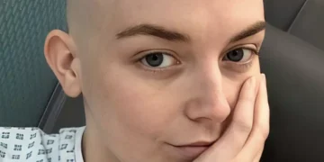 Alldaynews.gr «Αγνόησα τη φαγούρα και άλλα δύο συμπτώματα και στα 20 διαγνώστηκα με καρκίνο» – Τι έπρεπε να είχε προσέξει