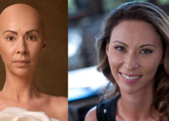 «Χώρισε την άρρωστη», είπαν στον σύντροφό μου – Ήμουν φαλακρή κι αυτός μου έλεγε «είσαι η πιο όμορφη γυναίκα»