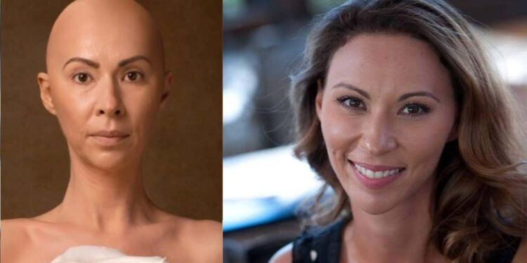 Alldaynews.gr «Χώρισε την άρρωστη», είπαν στον σύντροφό μου – Ήμουν φαλακρή κι αυτός μου έλεγε «είσαι η πιο όμορφη γυναίκα»