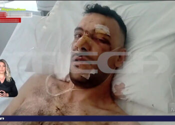 «Του αφαίρεσαν την σπλήνα, έχει τρύπες σε πνεύμονα, διάφραγμα και κόπηκαν οι μύες», λέει ο αδελφός του 35χρονου που μαχαιρώθηκε σε πανηγύρι