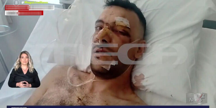 Alldaynews.gr «Του αφαίρεσαν την σπλήνα, έχει τρύπες σε πνεύμονα, διάφραγμα και κόπηκαν οι μύες», λέει ο αδελφός του 35χρονου που μαχαιρώθηκε σε πανηγύρι