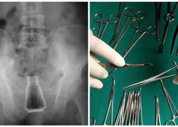 Πήγε στο Νοσοκομείο με ένα μπουκάλι αλάτι  στον πρωκτό! Σοκαρισμένοι και οι γιατροί