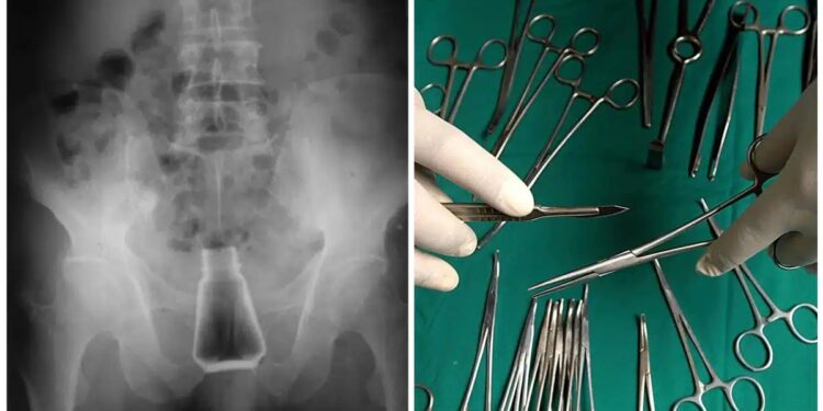 Alldaynews.gr Πήγε στο Νοσοκομείο με ένα μπουκάλι αλάτι στον πρωκτό! Σοκαρισμένοι και οι γιατροί