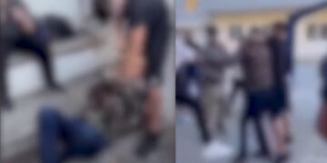 Στο φάσμα του αυτισμού ο 13χρονος που τον έκαψαν με τσιγάρο σε σχολείο – Τον κόλλησαν στον τοίχο και του πέταξαν μπάλα