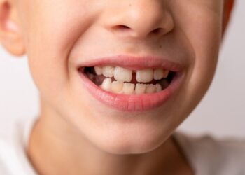 Διόρθωση Μικρών Δοντιών και Κενών: Συμμετρικό και Φυσικό Αποτέλεσμα