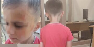 «Αφού τον έσπρωξε στον γκρεμό έχω απώλεια μνήμης, δεν θυμάμαι τι συνέβη», λέει ο δεύτερος ορειβάτης που σώθηκε από την επίθεση αρκούδας