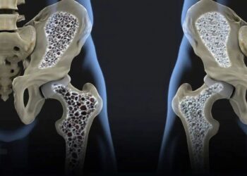 Εντυπωσιακές εικόνες: Εξερράγη το ηφαίστειο Λάκι Λάκι εκτοξεύοντας ένα σύννεφο τέφρας στα 10.000 μέτρα