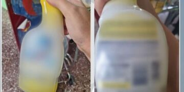 Μαθητής σε δημοτικό σχολείο κατάπιε καθαριστικό υγρό – Στο νοσοκομείο το παιδί με εμετούς