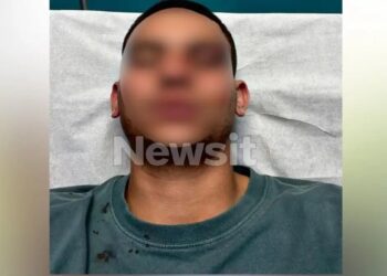 Για ένα like στο facebook, έστησε ενέδρα σε 18χρονο και τον έστειλε με σοβαρά τραύματα στο νοσοκομείο – Σε σοκ ο αδελφός του