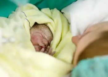 Έγκυος γέννησε μετά από 4 ώρες τοκετού – Μόλις οι γιατροί είδαν το στόμα του μωρού έπαθαν σοκ