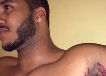 Εκεί που έκανε μπάνιο, ένιωσε κάτι να τον καίει κάτω από τη μασχάλη. Δεν ήταν όμως το σαπούνι…