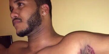 Alldaynews.gr Εκεί που έκανε μπάνιο, ένιωσε κάτι να τον καίει κάτω από τη μασχάλη. Δεν ήταν όμως το σαπούνι…