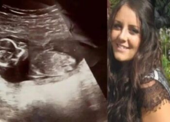 31χρονη δέκα μέρες μετά την έκτρωση πήγε στο γιατρό για εξετάσεις – Σοκαρισμένοι δεν πίστευαν ότι το μωρό