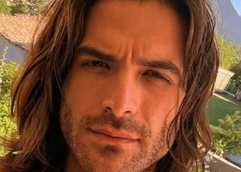 Άρης Μουγκοπέτρος: Η φωτογραφία με το χέρι του 3 μήνες μετά τον ακρωτηριασμό – Έβγαλε τα καρφιά από το δάχτυλό του