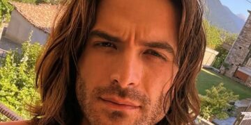 Άρης Μουγκοπέτρος: Η φωτογραφία με το χέρι του 3 μήνες μετά τον ακρωτηριασμό – Έβγαλε τα καρφιά από το δάχτυλό του