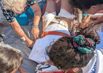 Σοκαριστικό ατύχημα στις Κυκλάδες: Κοντάρι ομπρέλας καρφώθηκε στο πόδι λουόμενης!