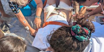 Alldaynews.gr Σοκαριστικό ατύχημα στις Κυκλάδες: Κοντάρι ομπρέλας καρφώθηκε στο πόδι λουόμενης!