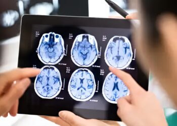 Πώς θα καταλάβετε ότι έχετε περάσει «σιωπηλό εγκεφαλικό»