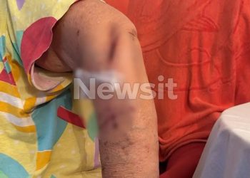 «Με μαχαίρωνε και μου φώναζε “μου ‘κανες μάγια”» λέει η ηλικιωμένη που δέχτηκε επίθεση από τον γείτονά της