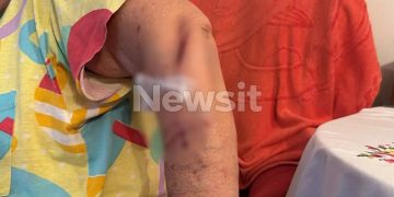 Alldaynews.gr «Με μαχαίρωνε και μου φώναζε “μου ‘κανες μάγια”» λέει η ηλικιωμένη που δέχτηκε επίθεση από τον γείτονά της