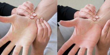 Alldaynews.gr Τι είναι το τεστ Allen και πως δείχνει εάν έχετε πρόβλημα στην καρδιά (video)