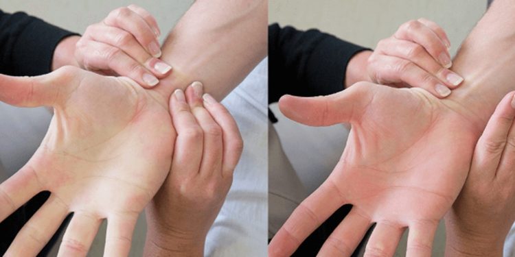 Alldaynews.gr Τι είναι το τεστ Allen και πως δείχνει εάν έχετε πρόβλημα στην καρδιά (video)