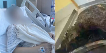 Alldaynews.gr Μητέρα έμεινε άφωνη με την ανακάλυψη των γιατρών – Η «δυσανεξία» της κόρης της στη γλουτένη ήταν στην πραγματικότητα…