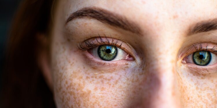 Alldaynews.gr Κηλίδες στο πρόσωπο: Γιατί εμφανίζονται και πώς θα τις αντιμετωπίσουμε;