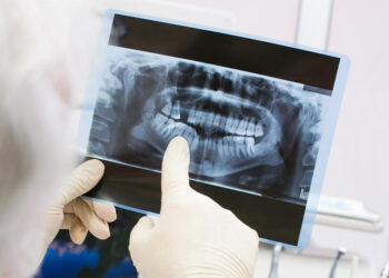 Μητέρα πήγε την κόρη της στον οδοντίατρο για μία πανοραμική ακτινογραφία – Αυτό που αποκαλύφθηκε την άφησε άφωνη