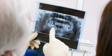 Μητέρα πήγε την κόρη της στον οδοντίατρο για μία πανοραμική ακτινογραφία – Αυτό που αποκαλύφθηκε την άφησε άφωνη