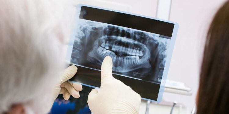 Μητέρα πήγε την κόρη της στον οδοντίατρο για μία πανοραμική ακτινογραφία – Αυτό που αποκαλύφθηκε την άφησε άφωνη