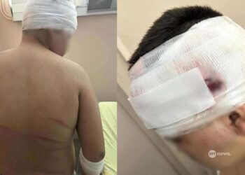 Alldaynews.gr Ξεσπά ο πατέρας του 13χρονου που ξυλοκοπήθηκε άγρια – «Τρέχω για να κάνω κάτι που δεν κάνει η αστυνομία» (video)