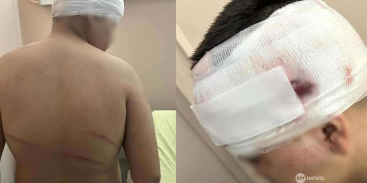 Ξεσπά ο πατέρας του 13χρονου που ξυλοκοπήθηκε άγρια – «Τρέχω για να κάνω κάτι που δεν κάνει η αστυνομία» (video)