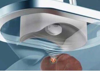 Δημιουργήθηκε ρομπότ που καταστρέφει καρκινώματα με υπέρηχο