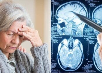 Άνοια: Η πασiγνωστη βιταμiνη που σώζει το μυαλό των 80ρηδων