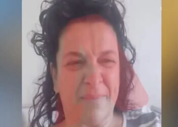 «Έχανα πολύ αίμα, λιποθυμούσα και έκανα εμετό» λέει η γυναίκα που τραυματίστηκε από την πτώση δέντρου στο κέντρο της Αθήνας