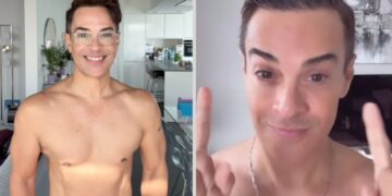 Alldaynews.gr «Είμαι 58 αλλά φαίνομαι 30 επειδή κάνω αυτό το φυσικό μπότοξ» – Ποιο είναι το μυστικό του για τη νεανική εμφάνιση