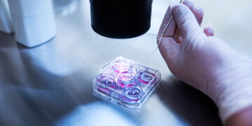 Μικρογονιμοποίηση (ICSI): Διαδικασία,Ενδείξεις και Σημασία