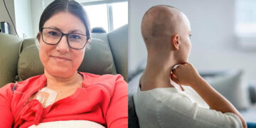 Της έδιναν μόνο δυο χρόνια ζωής όμως 12 χρόνια μετά είναι πιο δυνατή από ποτέ – Πώς αντιμετωπίζει τους πολλαπλούς καρκίνους η 31χρονη;