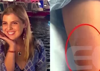 Μαρίσσα Λαιμού: Αυτή είναι η αιτία θανάτου σύμφωνα με την ιατροδικαστική εξέταση – Η οργή της οικογένειας και οι αποκαλύψεις για το μοιραίο τσίμπημα