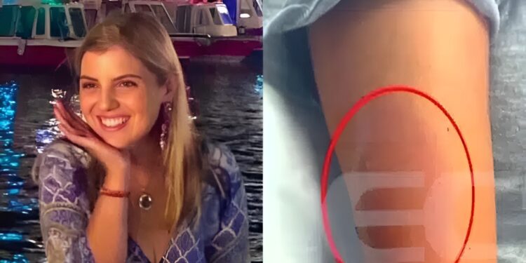 Alldaynews.gr Μαρίσσα Λαιμού: Αυτή είναι η αιτία θανάτου σύμφωνα με την ιατροδικαστική εξέταση – Η οργή της οικογένειας και οι αποκαλύψεις για το μοιραίο τσίμπημα