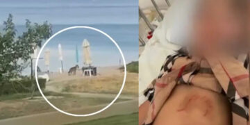 Alldaynews.gr Βίντεο με τον λύκο που επιτέθηκε και τραυμάτισε ένα 5χρονο κοριτσάκι στη Χαλκιδική