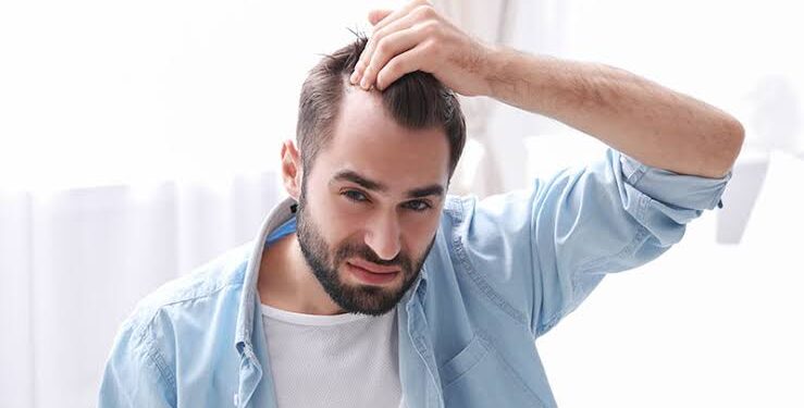 Alldaynews.gr Πώς να αντιμετωπίσεις την τριχόπτωση με το Androxil και να ξαναβρείς την αυτοπεποίθησή σου!