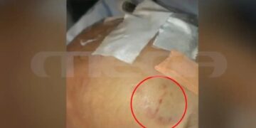 Alldaynews.gr «Για τον θάνατό του υποψιάζομαι την μάνα, την πρώην ή την πεθερά μου» λέει ο πατέρας του 2,5 μηνών βρέφους